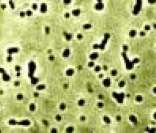 Imagem em microscópio de uma colônia de bactérias