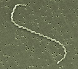Imagem da bactéria da leptospirose